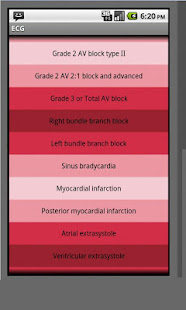 Electrocardiogram ECG Types(圖2)-速報App