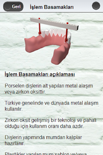 How to mod Titanyum Hassas Tutucu 1.1 mod apk for bluestacks