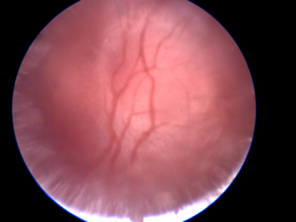  OcuScience