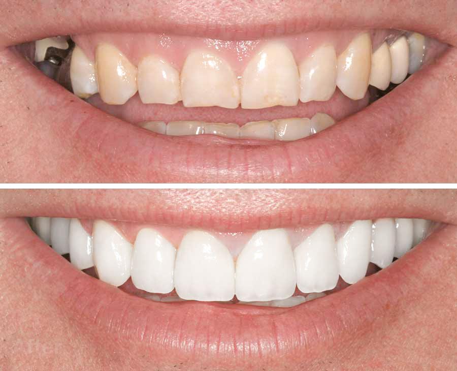  Inspire Dental of Summerlin- Dr. Matthew J. Wilson