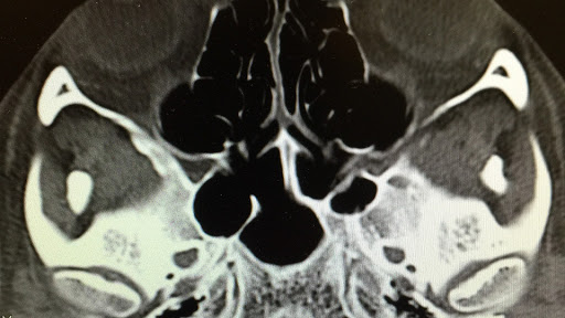  Advance Oral & Maxillofacial Surgery - Steven Saxe, DMD