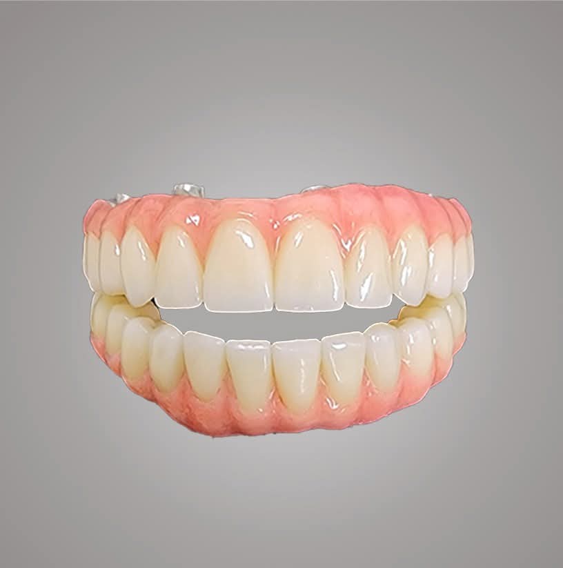 Digital dental implants