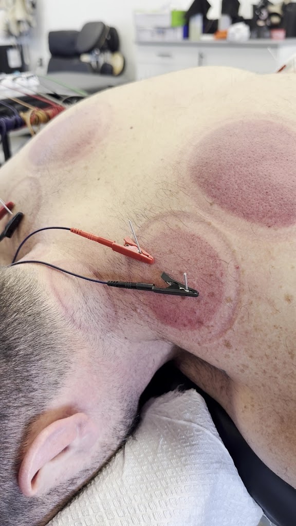  Align Physical Therapy
