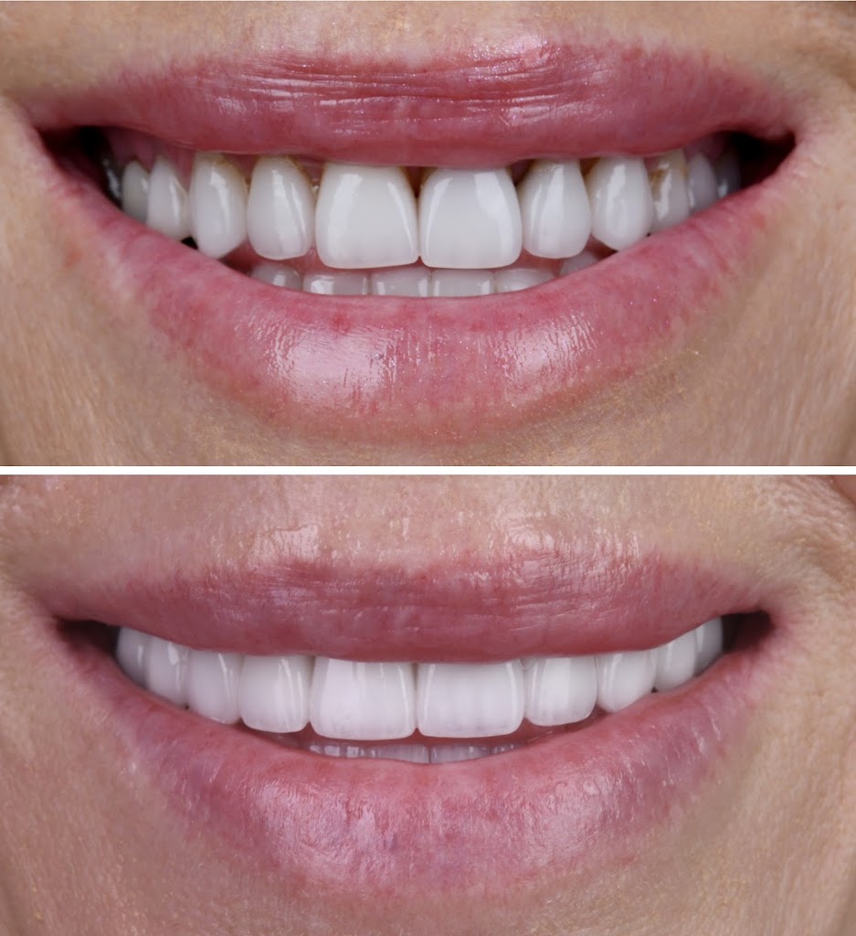  Vegas Smile Suite | Tozzi & Lawler