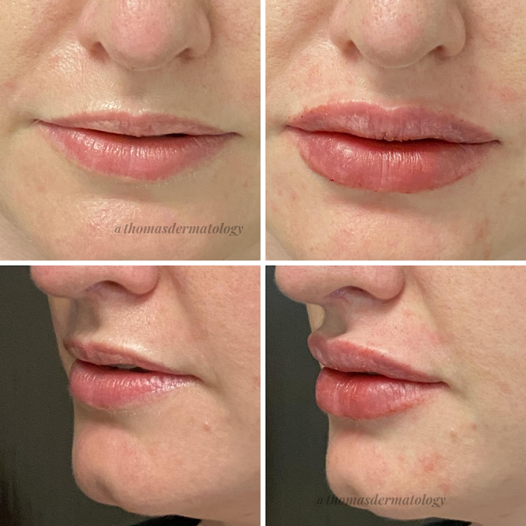  Thomas Dermatology