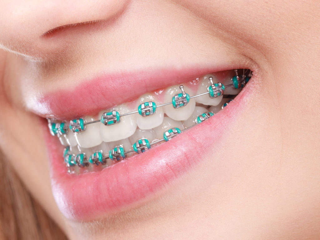 Happy Smiles Dental Group