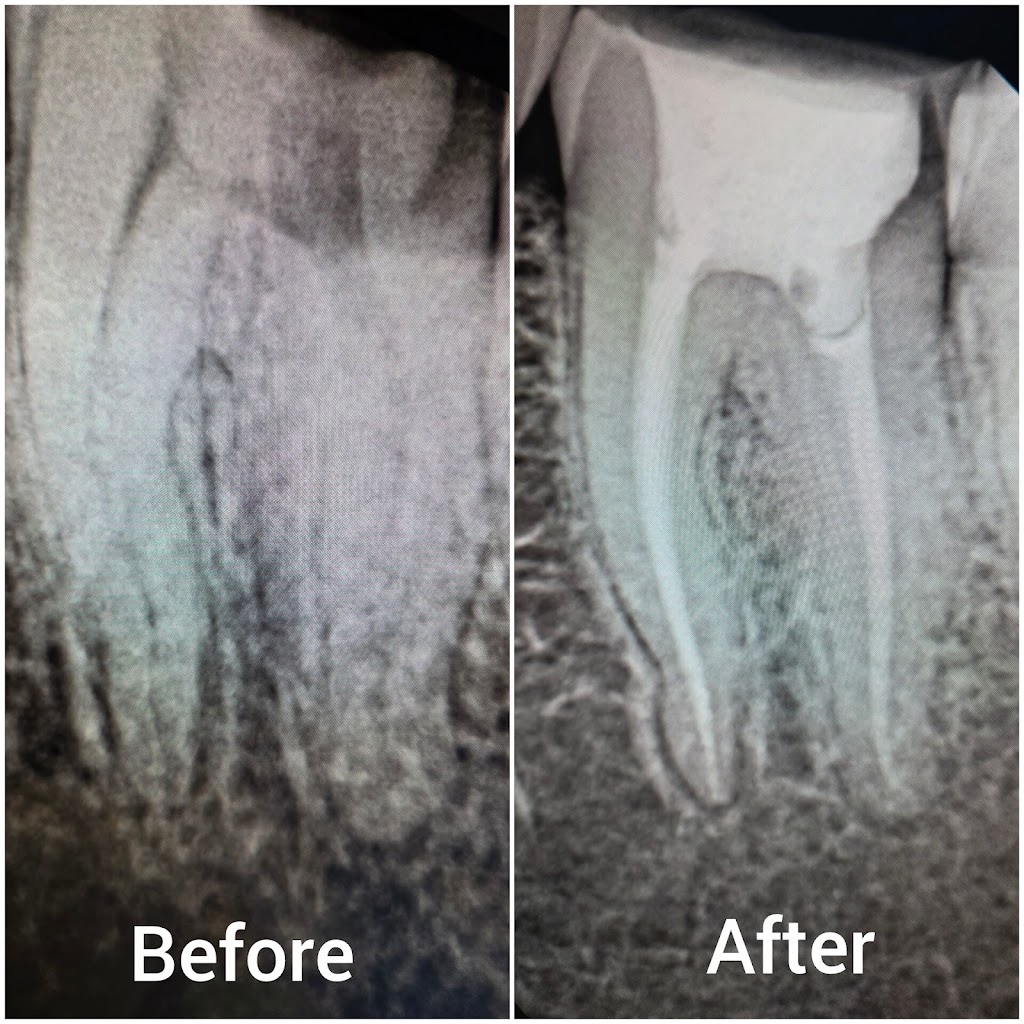  AK Ultimate Dental