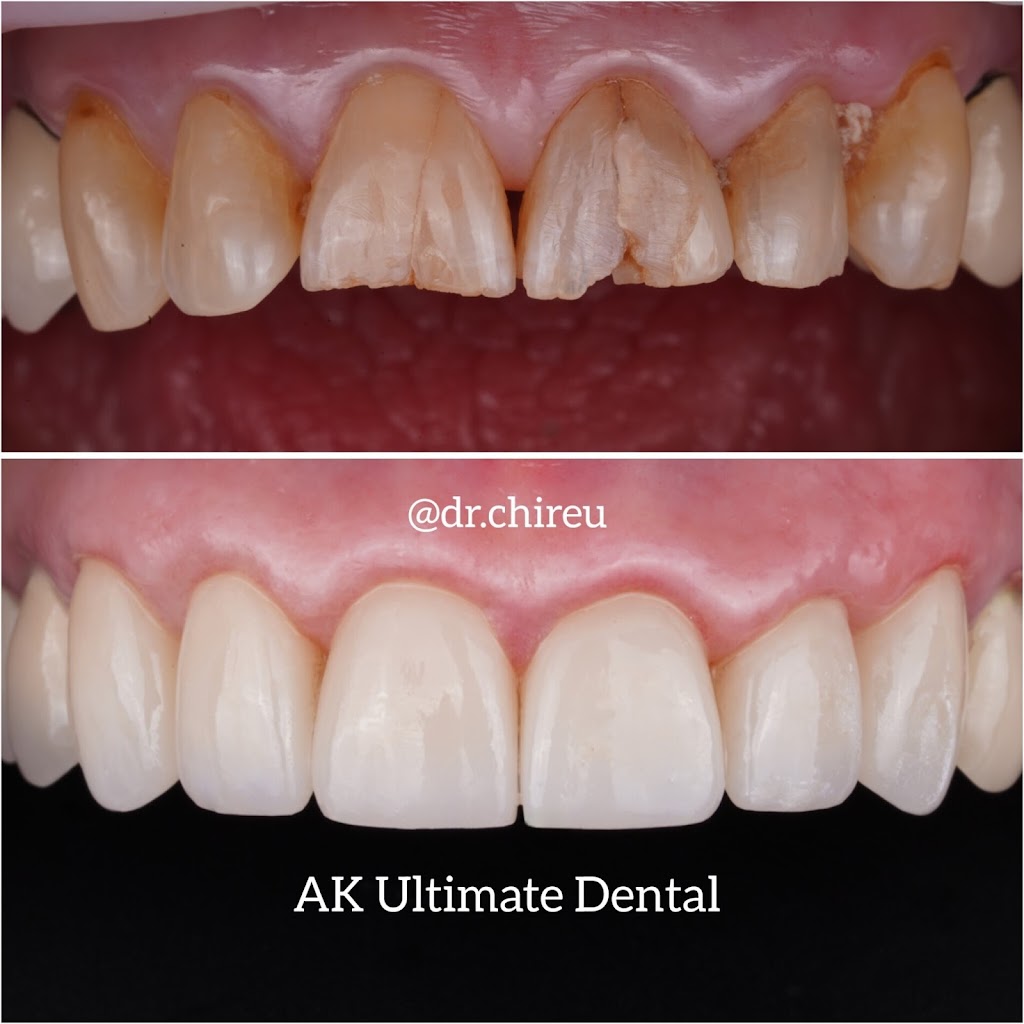  AK Ultimate Dental