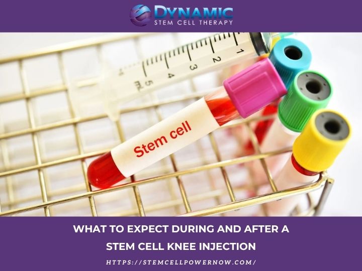  Stem Cell Therapy Las Vegas | Dynamic Stem Cell Therapy