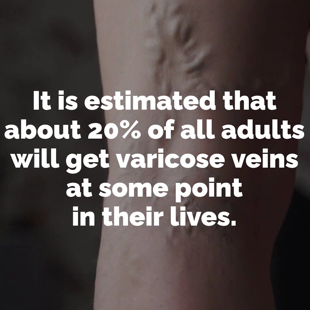  Prem K. Kittusamy, M.D. | Varicose Vein and Spider Vein Specialist