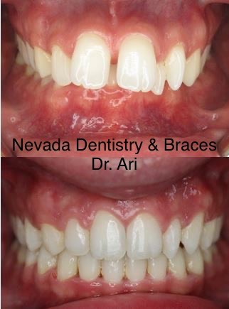  Nevada Dentistry & Braces