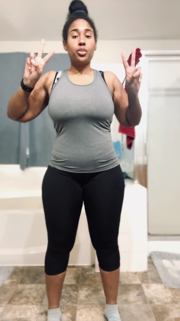  LipoSculp Vegas
