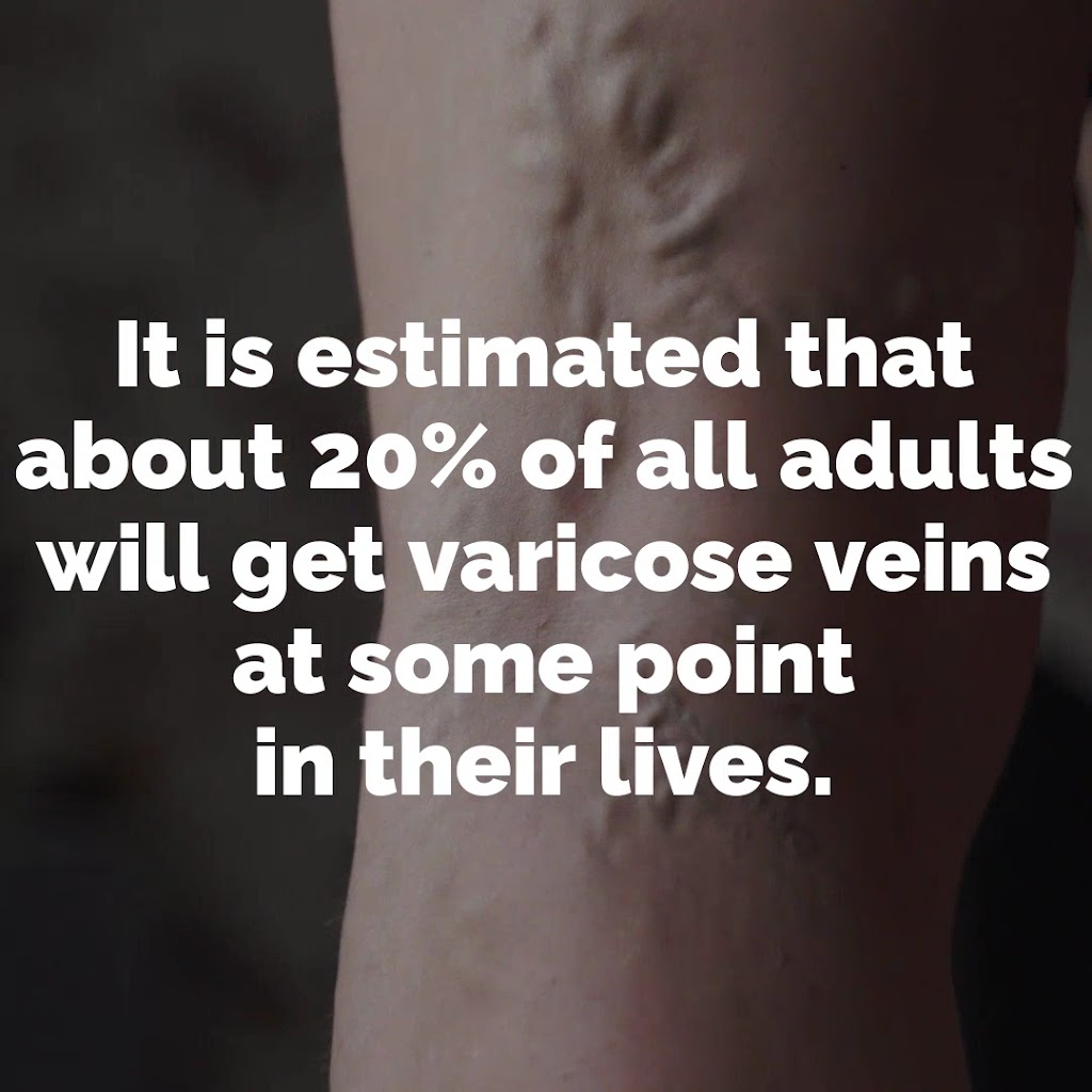  Prem K. Kittusamy, M.D. | Varicose Vein and Spider Vein Specialist