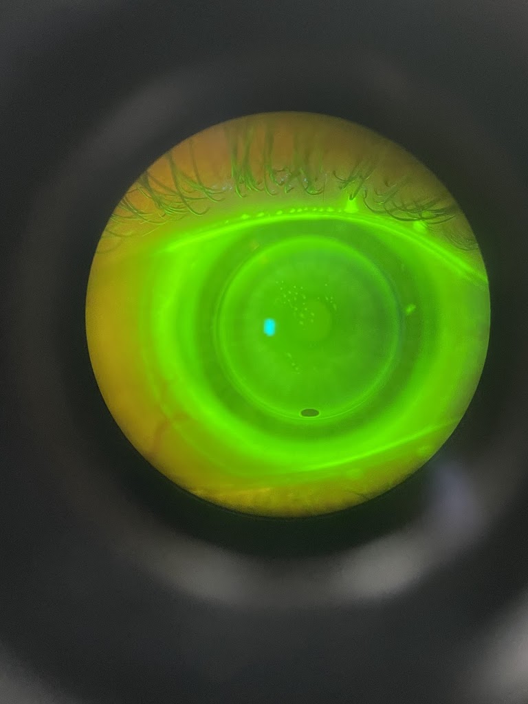 Insight Eye Care