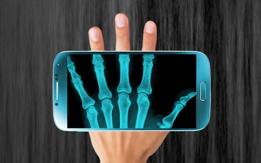 X-Ray Scanner Prank Screen 3