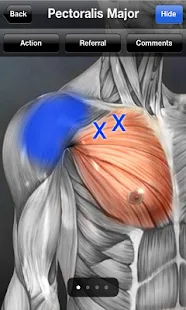 Muscle Trigger Point Anatomy - screenshot thumbnail
