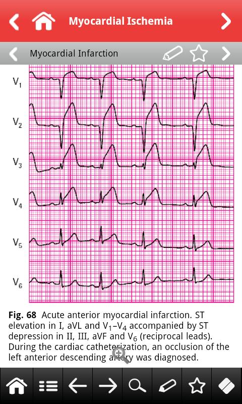ECG pocket Screen 3