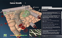 bodyxq cancer