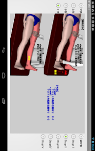 ブルンストロームステージ（片麻痺機能検査）(圖8)-速報App