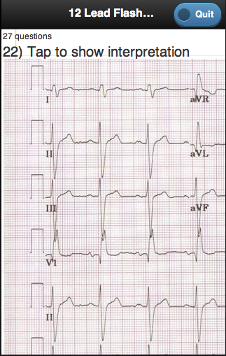 ECG Academy