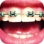 Cover Image of Tải xuống Dental Brace Booth 37.1.0.41 APK