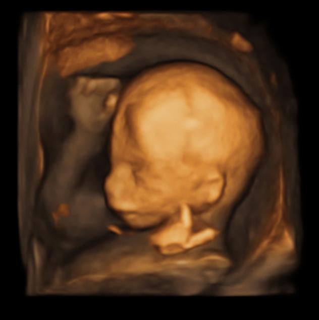 Pregnancy by week Screen 3