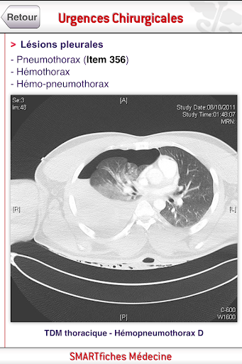 【免費醫療App】SMARTfiches Urgences Chir-APP點子