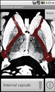 NeuroSlice(圖2)-速報App