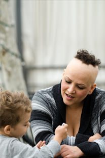 Alopecia Symptoms FREE Screenshots 4