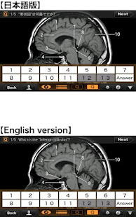 Interactive CT and MRI Anatomy(圖4)-速報App