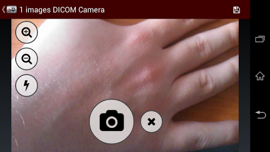 Dicompass DICOM Camera(圖7)-速報App