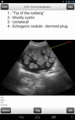 【免費教育App】ARDMS OBGYN Ultrasound Cards-APP點子