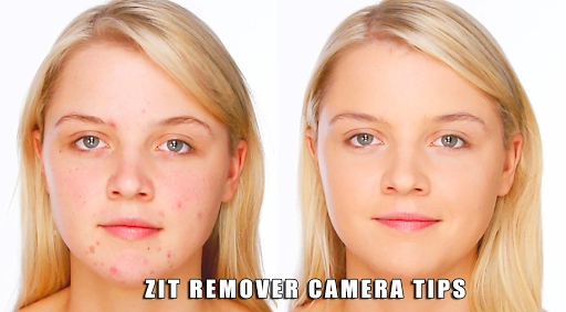 Zit Remover Camera Tips