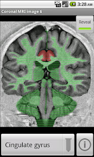 NeuroSlice(圖1)-速報App