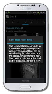 Radiological Anatomy For FRCR1(圖2)-速報App