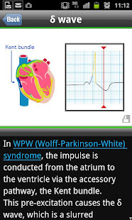 easy ECG training(圖3)-速報App
