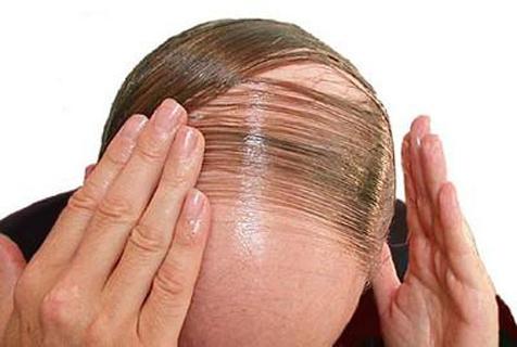 Hair Fall Control