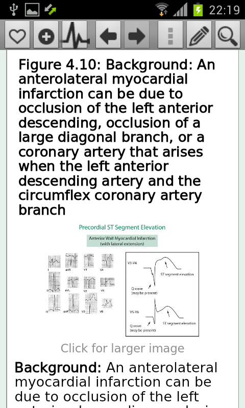 ECG Interpretation Everyone Screen 3
