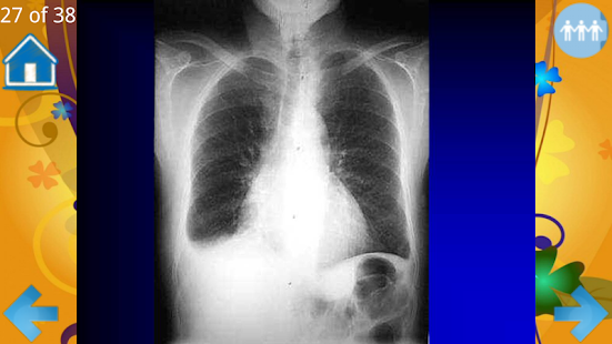 Examination of the heart Screenshots 5