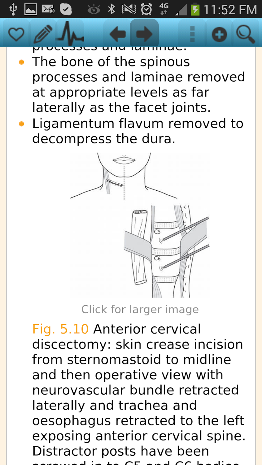 Neuroanaesthesia Screen 3