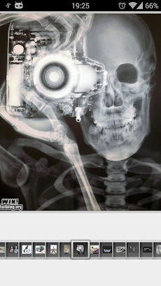 Super Funny X-Rayのおすすめ画像2