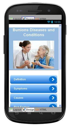 Bunions Disease Symptoms