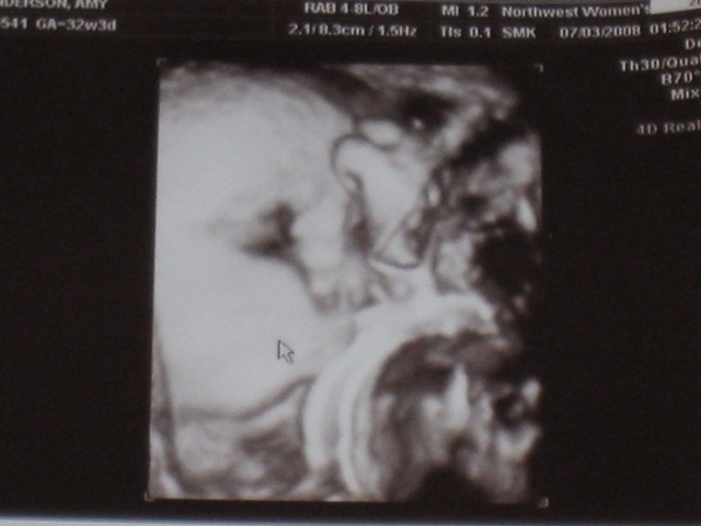 [ultrasound1[1].jpg]