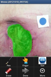 MOWA – Wound Care Solution Screen 2