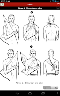 Bandaging and Splinting Screenshots 19