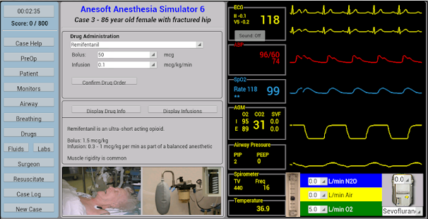 Anesthesia Sim 6(圖2)-速報App