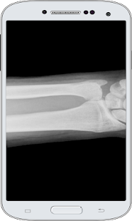 X-Ray Scanner Screenshots 2