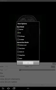 LEADTOOLS DICOM Viewer App(圖5)-速報App