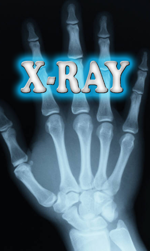 X-Ray Scanner