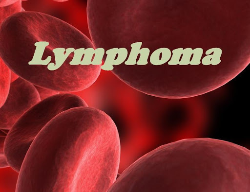 Lymphoma